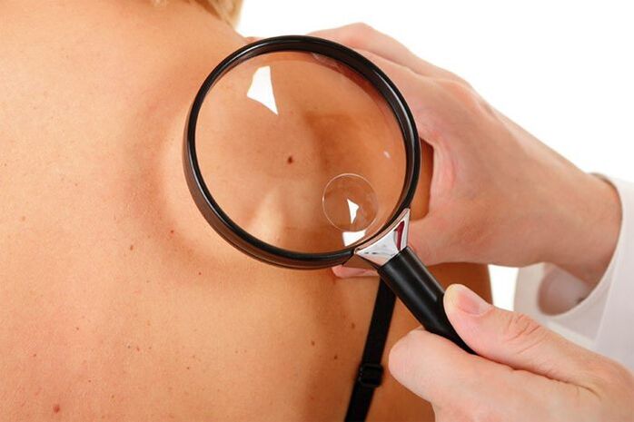 Untersuchung eines Patienten mit HPV